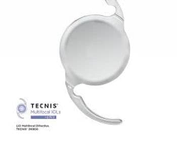 Lente Multifocal Tecnis da Johnson. Paciente enxerga para longe, intermediário e para perto após a cirurgia.