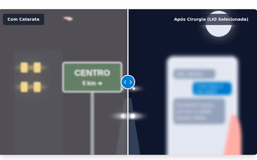 Comparação lado a lado da visão com catarata, embaçada e com halos, e depois da cirurgia, nítida.