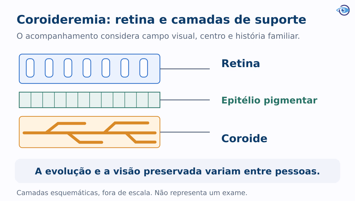 Corte educativo das camadas do fundo do olho, mostrando retina sensível à luz, epitélio pigmentar de suporte e coroide vascular. Ilustração fora de escala.
