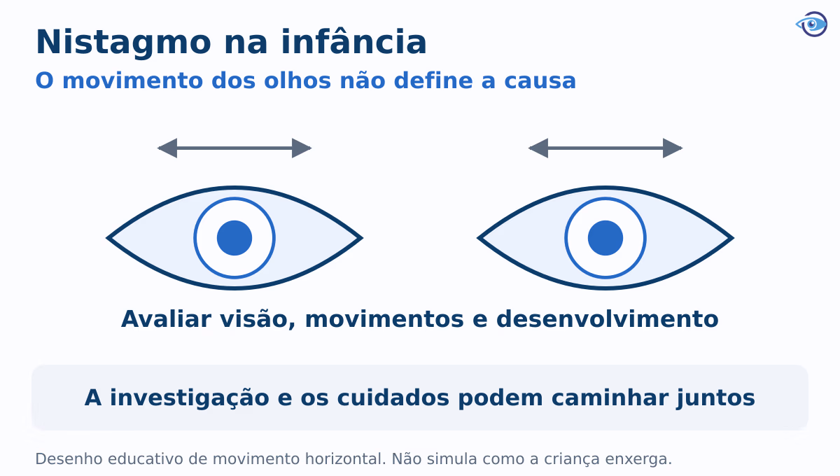 Esquema educativo mostra movimentos involuntários dos olhos e diferentes aspectos da avaliação: visão, controle dos movimentos e desenvolvimento. Não simula a visão da criança. Esquema educativo mostra movimentos involuntários dos olhos e diferentes aspectos da avaliação: visão, controle dos movimentos e desenvolvimento. Não simula a visão da criança.