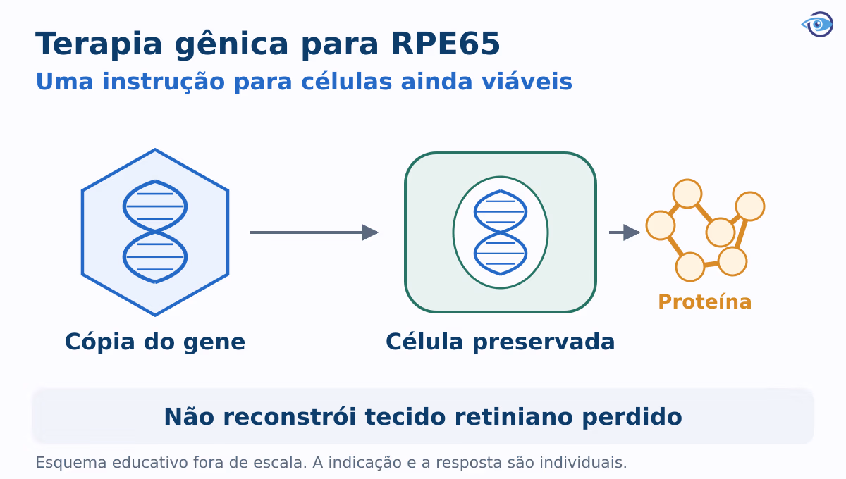 Esquema educativo da entrega de uma cópia funcional do RPE65 a células ainda viáveis do epitélio pigmentar. O mecanismo não reconstrói tecido retiniano perdido. Esquema educativo da entrega de uma cópia funcional do RPE65 a células ainda viáveis do epitélio pigmentar. O mecanismo não reconstrói tecido retiniano perdido.