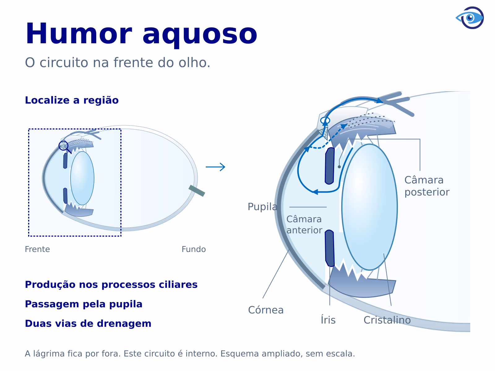 Corte do olho com a frente à esquerda, contexto do globo e ampliação das câmaras anterior e posterior. Setas acompanham a passagem pela pupila e duas vias de drenagem, sem atravessar íris ou cristalino.