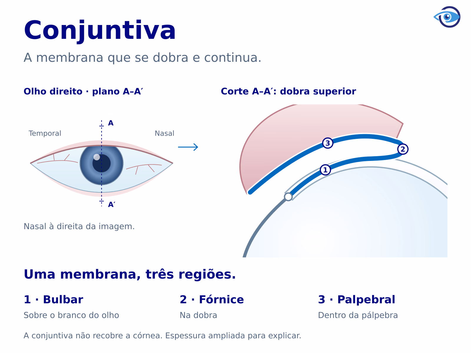 Olho direito de frente com um plano de corte marcado. O corte lateral e sua ampliação mostram uma membrana contínua sobre a esclera anterior, na dobra do fórnice e na face interna da pálpebra, sem recobrir a córnea.