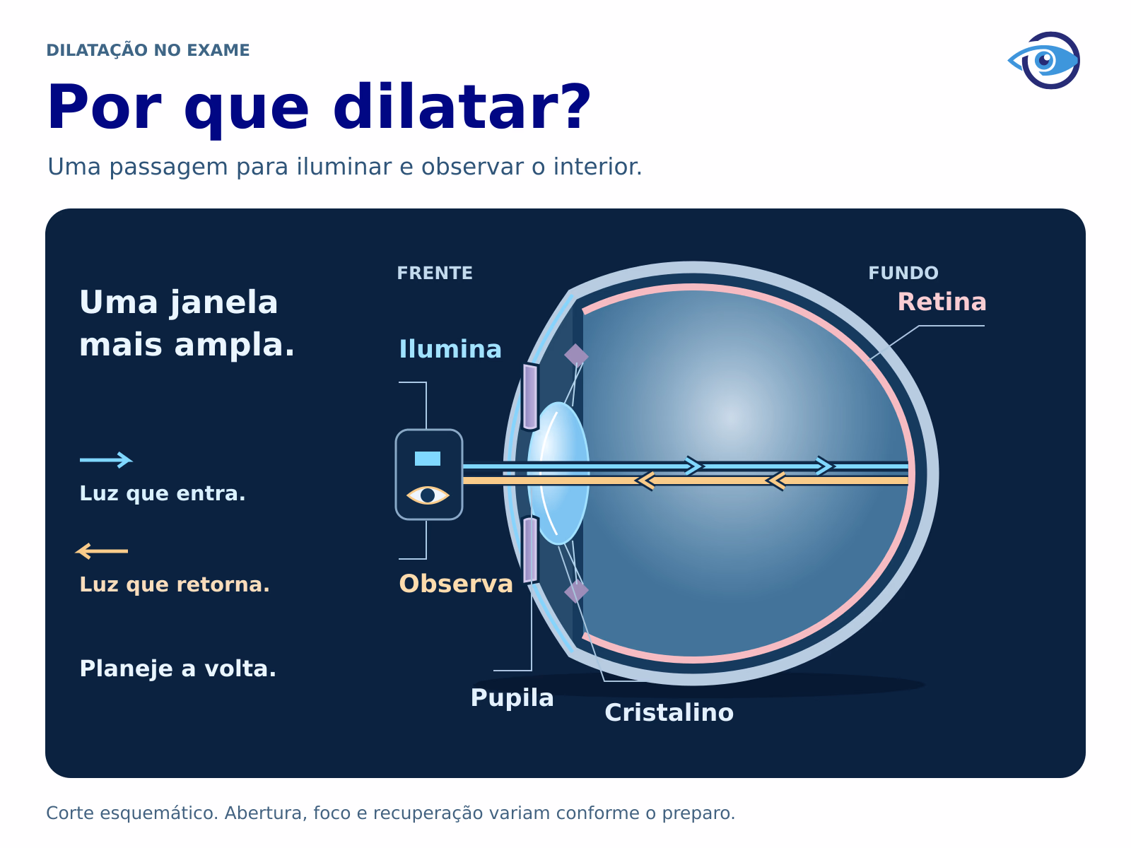Ilustração original do olho em corte, com frente à esquerda e fundo à direita. Luz azul entra pela pupila; luz dourada retorna do fundo ao instrumento e ao observador. A abertura está ampliada. Os caminhos são conceituais, sem campo ou refração calculados.