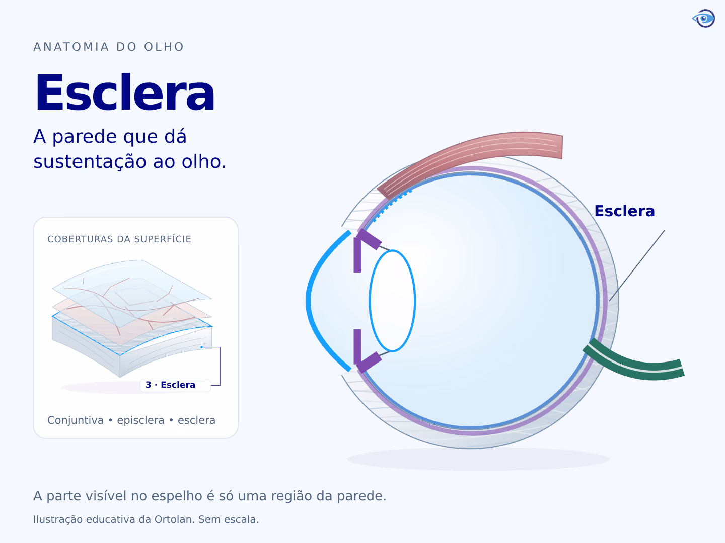Ilustração do olho em corte com esclera como parede externa, um ponto de fixação muscular e ampliação das coberturas da região branca. Ilustração do olho em corte com esclera como parede externa, um ponto de fixação muscular e ampliação das coberturas da região branca.