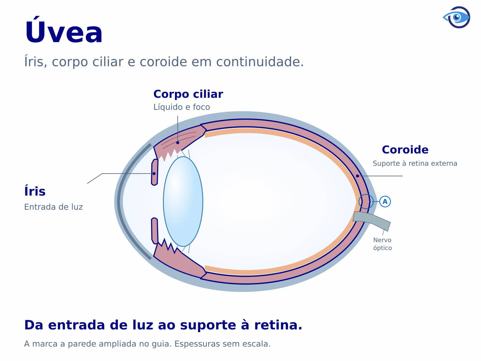 Corte do olho com a frente à esquerda. Uma identificação contínua e chamadas ancoradas acompanham íris, corpo ciliar e coroide. Retina e cristalino ficam fora da úvea; o ponto A marca a parede posterior, ampliada no guia.