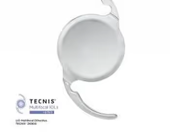 Lente Multifocal Tecnis da Johnson. Paciente enxerga para longe, intermediário e para perto após a cirurgia. Lente Multifocal Tecnis da Johnson. Paciente enxerga para longe, intermediário e para perto após a cirurgia.