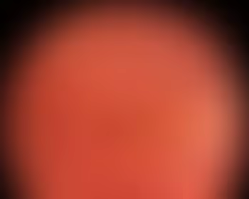 O que é a Retinografia?