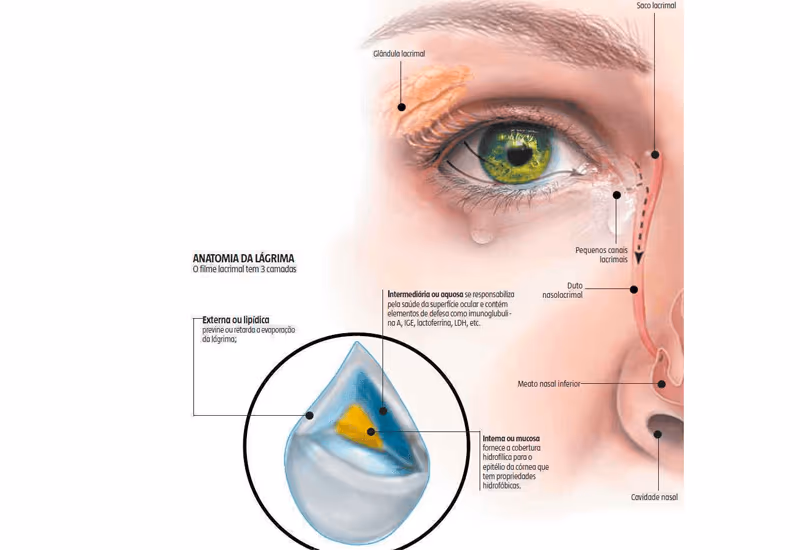 Trajeto da lágrima: produzida pelas glândulas e escoada pelo sistema canalicular. A oclusão do ponto lacrimal pode ser muito útil em casos sérios de olho seco.