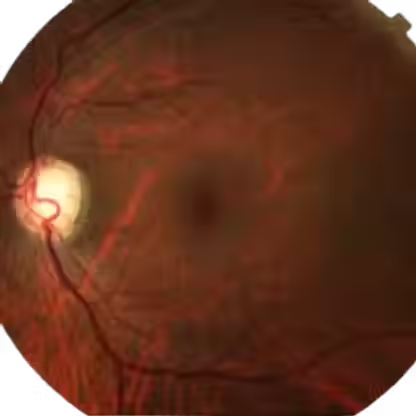 EXAMES ESPECIALIZADOS