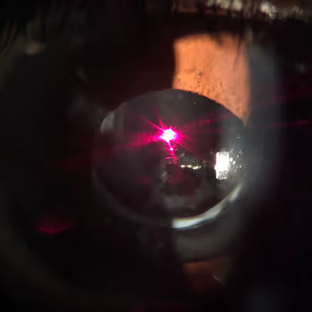 TÉCNICAS À LASER para Limpeza das Lentes Intraoculares (Capsulotomia à YAg Laser). TÉCNICAS À LASER para Limpeza das Lentes Intraoculares (Capsulotomia à YAg Laser).