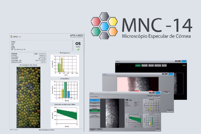 Esquema mostrando o microscópio especular de córnea usado na Ortolan Oftalmologia.