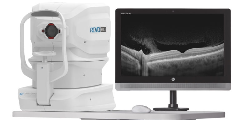 Foto do novo REVO 60 - OCT da Ortolan Oftalmologia - "ALL IN ONE".
