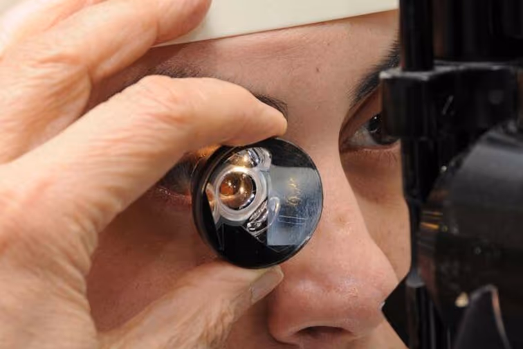 Exame de gonioscopia para avaliação do ângulo iridocorneano.