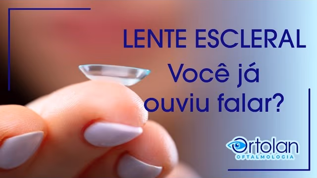 Lentes esclerais modernas para ceratocone e córneas especiais