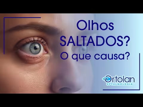 Olhos saltados podem ser doença da tireoide