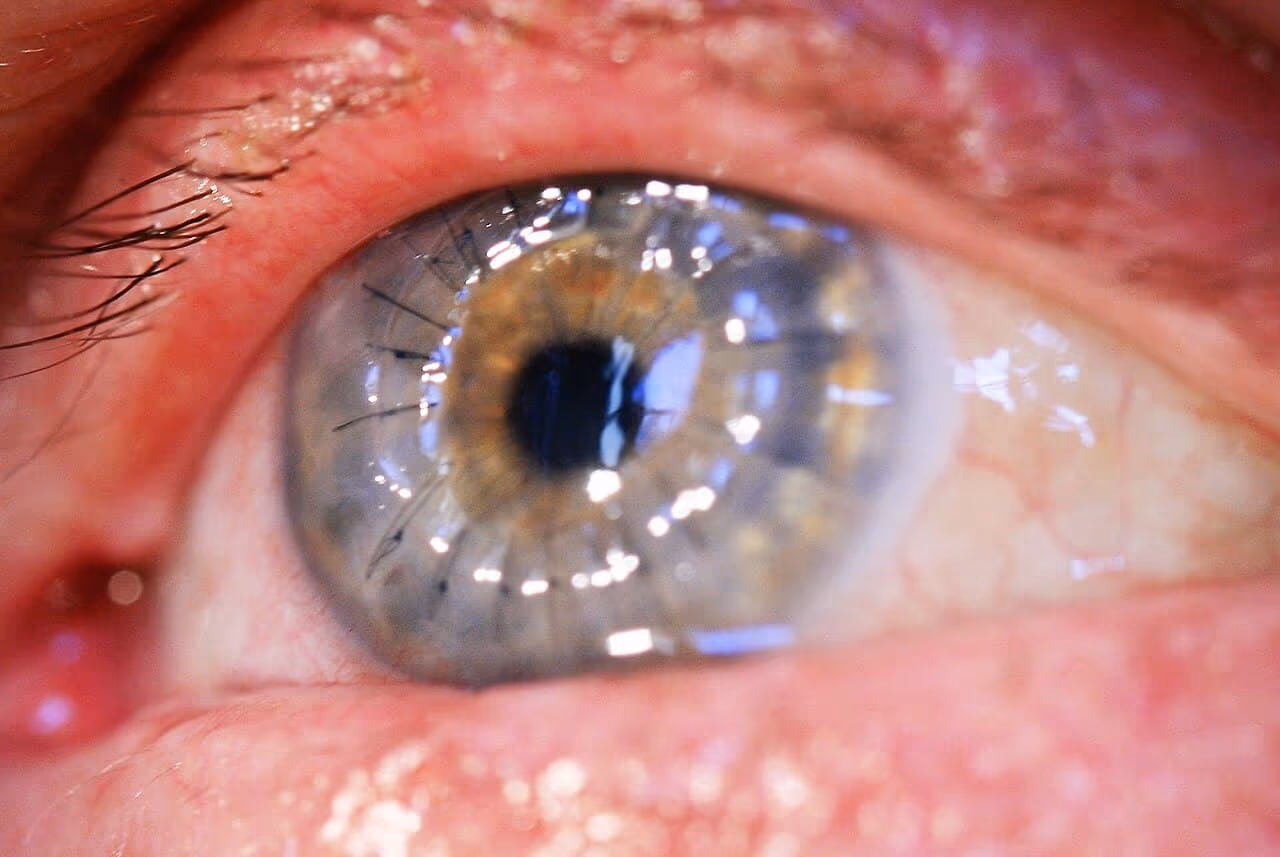 Close do olho humano em destaque.